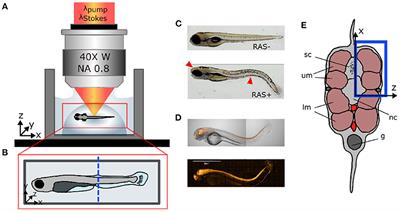 Toward Quantitative in vivo Label-Free Tracking of Lipid Distribution in a Zebrafish Cancer Model